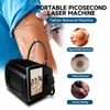 Мини Новое поступление Q Switched Nd Yag Laser 1064nm 532nm Carbon Peel Машина для удаления татуировок 