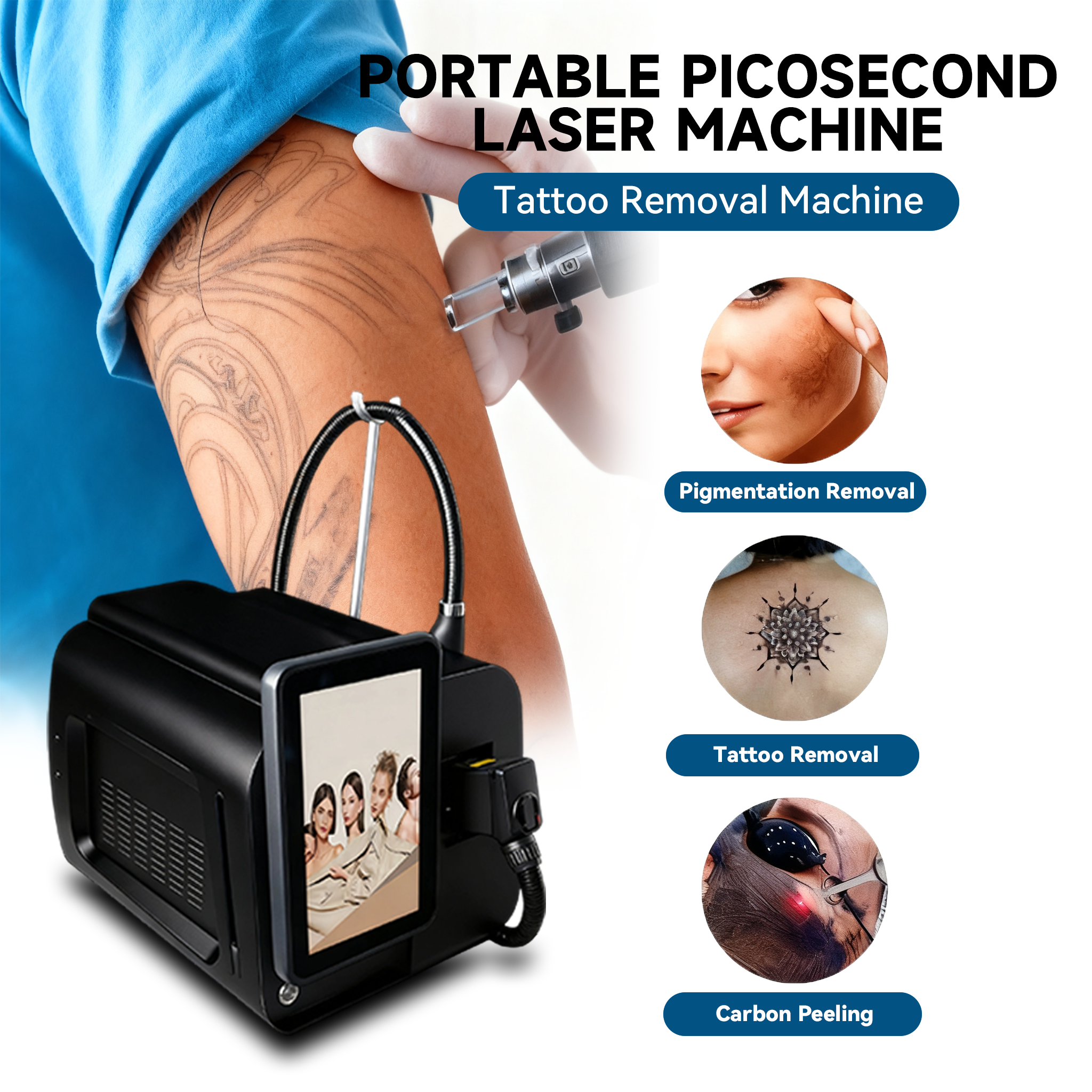 Мини Новое поступление Q Switched Nd Yag Laser 1064nm 532nm Carbon Peel Машина для удаления татуировок 